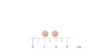 ETINILESTRADIOL/DROSPIRENONA STADA 0,02 mg/3 mg COMPRIMIDOS RECUBIERTOS CON PELICULA EFG